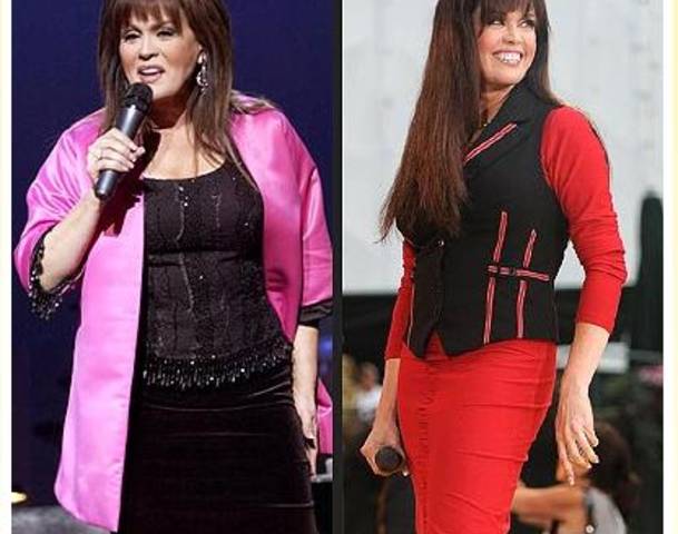 Marie Osmond Before and After