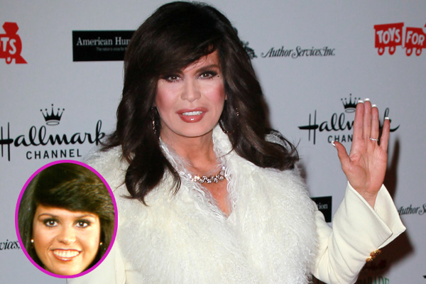 Marie Osmond Before and After