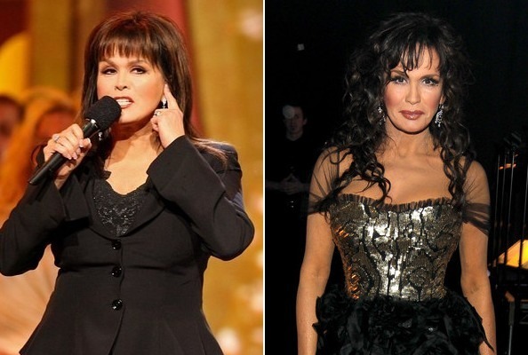 Marie Osmond Before and After