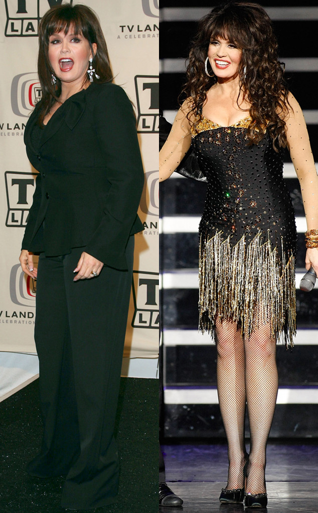 Marie Osmond Before and After